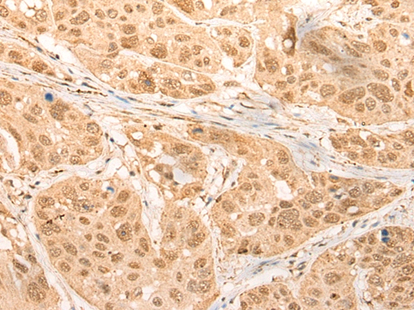 CDKN2AIPNL Antibody[46457]