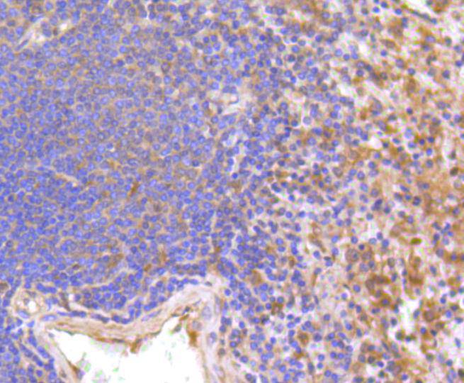 IFNAR1 Rabbit mAb[48656]