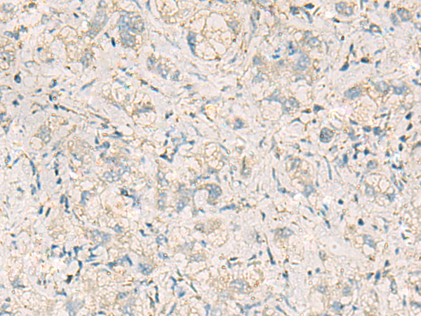 WDR37 antibody[31994]