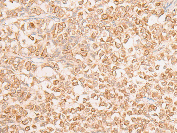 EN2 Antibody[47108]