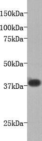 LPA receptor 1 Antibody[48025]