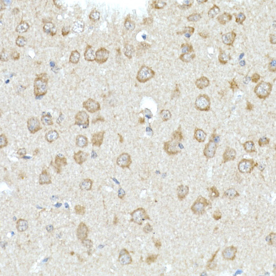 RHOT2 Polyclonal Antibody[3042