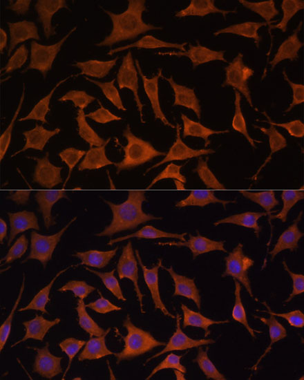 TNF-α Polyclonal Antibody[2908