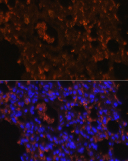 TLR2 Polyclonal Antibody[29071