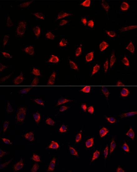 NEDD1 Polyclonal Antibody[3063