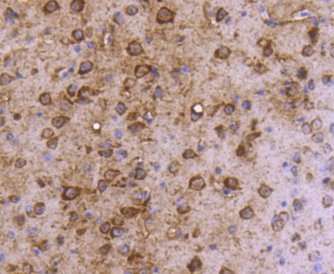 MAP1LC3A Rabbit mAb[49049]