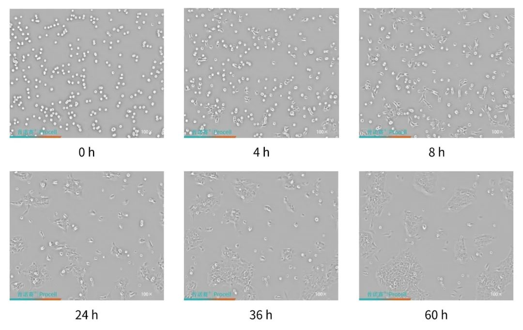 MCF 10A传代后状态变化