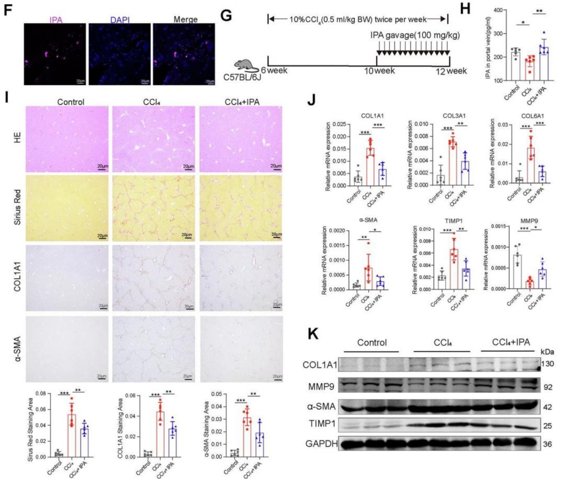 CMI | 肠道菌群代谢物IPA或成为肝硬化新候选药物
