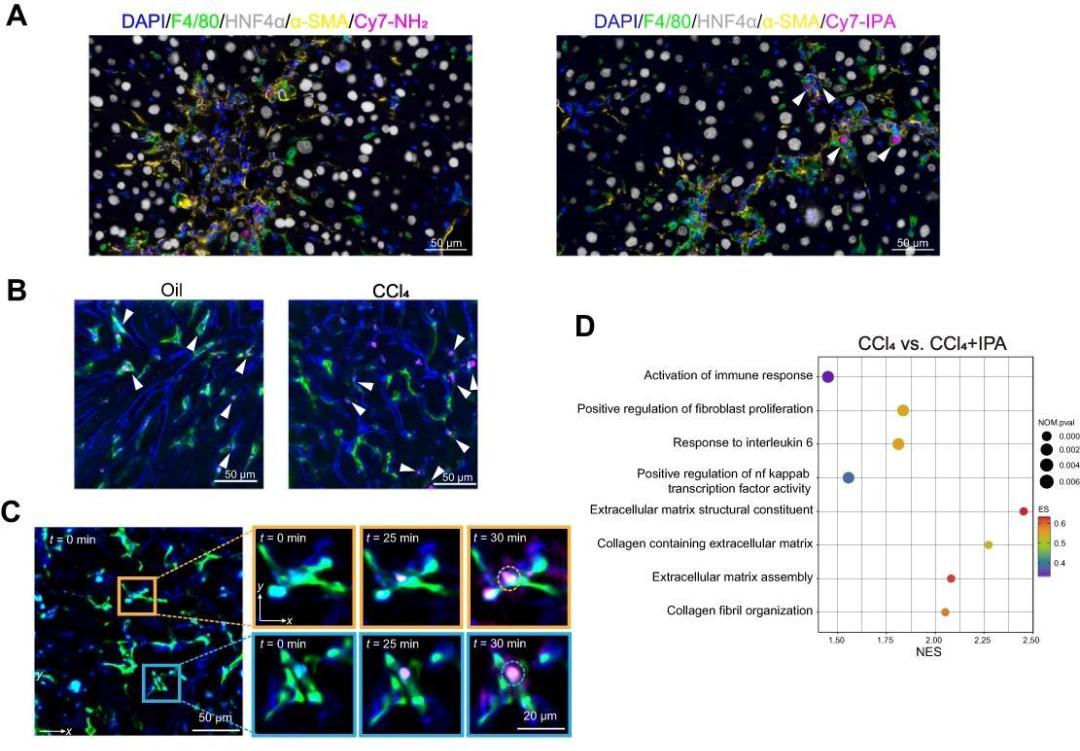 CMI | 肠道菌群代谢物IPA或成为肝硬化新候选药物