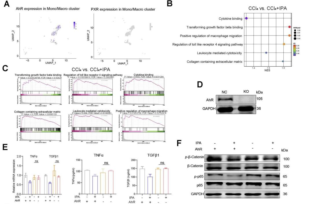 CMI | 肠道菌群代谢物IPA或成为肝硬化新候选药物