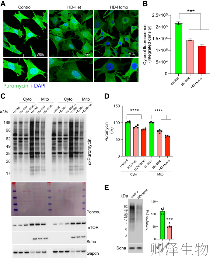 【线粒体翻译】  线粒体翻译大塞车！亨廷顿病新型致病机制破解