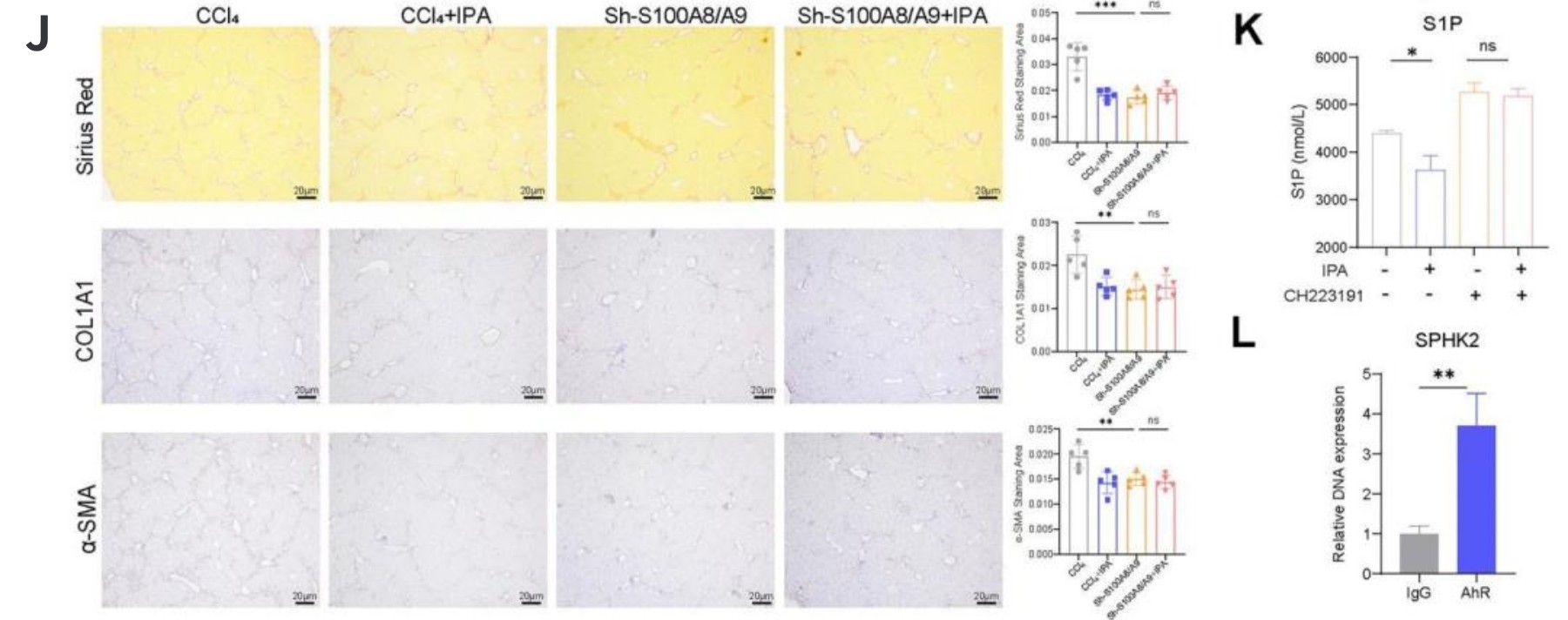 CMI | 肠道菌群代谢物IPA或成为肝硬化新候选药物