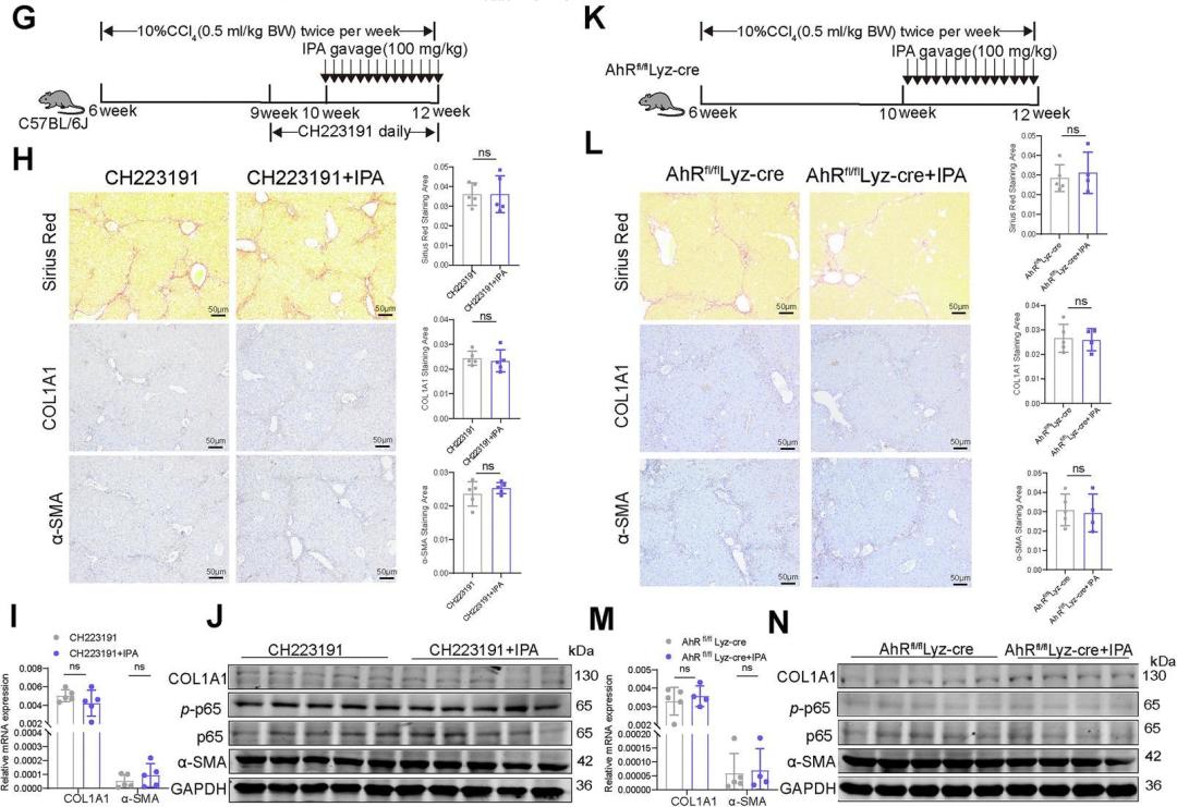 CMI | 肠道菌群代谢物IPA或成为肝硬化新候选药物