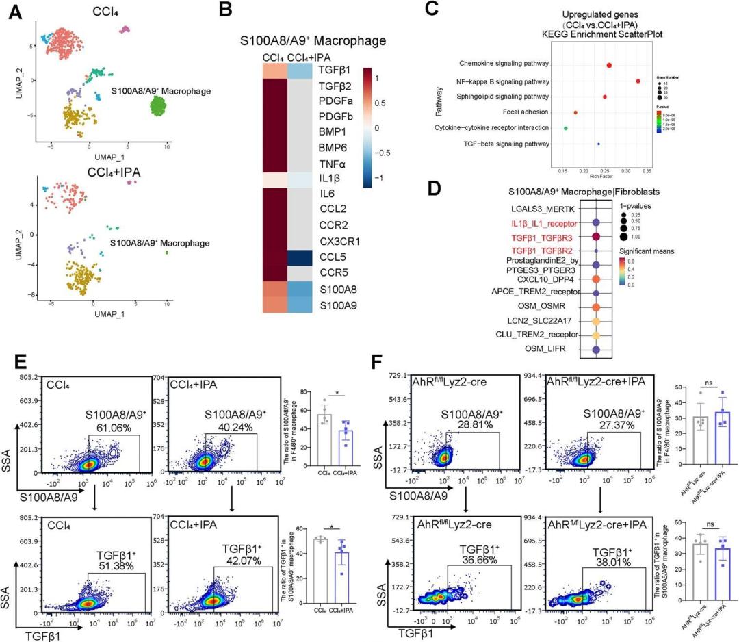 CMI | 肠道菌群代谢物IPA或成为肝硬化新候选药物