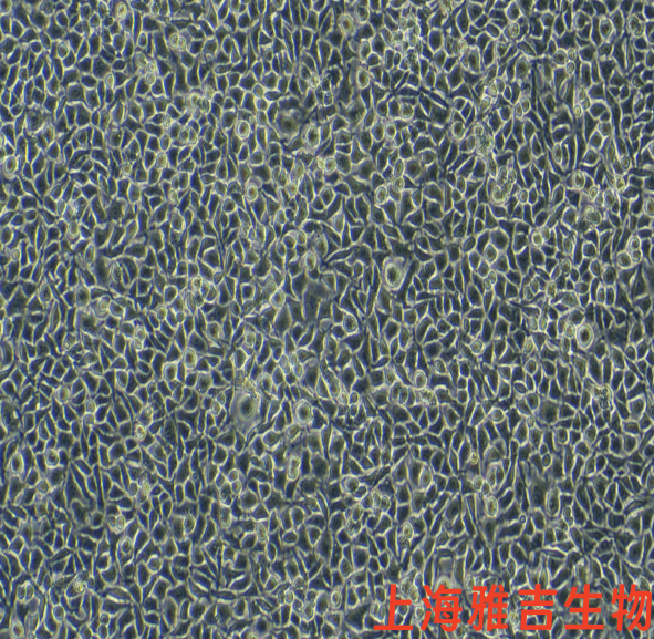 原代大鼠肾盂输尿管连接处cajal间质细胞培养条件