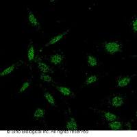 PLK1 / PLK-1 兔多抗 (抗原亲和纯化)