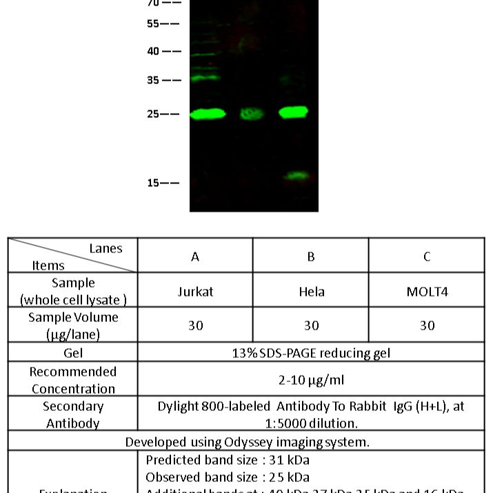 IL-1 beta 多抗 (抗原亲和纯化)