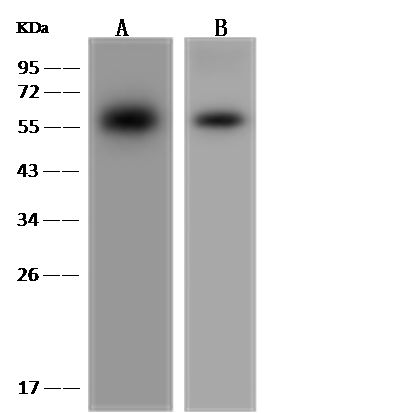 Sino Biological GPT2兔多抗 抗原亲和纯化 适用WB/IHC-P/IP gpt2 antibody