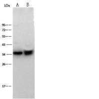 CD40/TNFRSF5 Antibody, Rabbit PAb, Antigen Affinity Purified | CD40/TNFRSF5 兔多抗 (抗原亲和纯化)