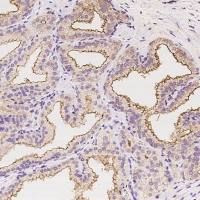 TMPRSS2 兔多抗 | TMPRSS2 Antibody, Rabbit PAb