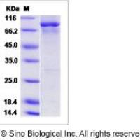 EGFR重组蛋白|Recombinant Human EGFR / HER1 / ErbB1 (aa 668-1210) Protein (His & GST Tag)