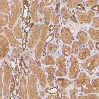 IFIT2 兔多抗 (抗原亲和纯化)