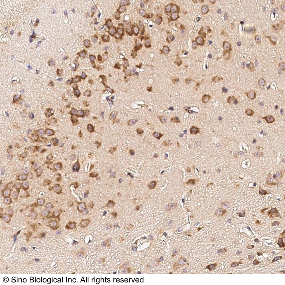 CD45/PTPRC Antibody, Rabbit PAb, Antigen Affinity Purified | CD45/PTPRC 兔多抗 (抗原亲和纯化)