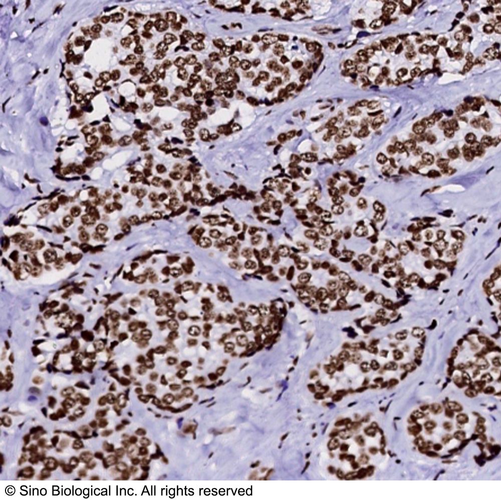HIST2H2BE 兔多抗 (抗原亲和纯化)
