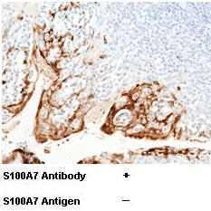 S100A7 兔多抗 (抗原亲和纯化)