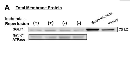 WB条带若隐若现，一定要这样做！