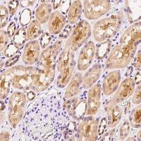 FGF5 兔多抗 (抗原亲和纯化)