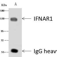 IFNAR1 兔多克隆抗体 (抗原亲和纯化)