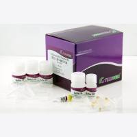 质粒小提中量试剂盒(DP106)