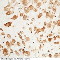 SOD2 Antibody, Rabbit PAb, Antigen Affinity Purified | SOD2 兔多抗 (抗原亲和纯化)