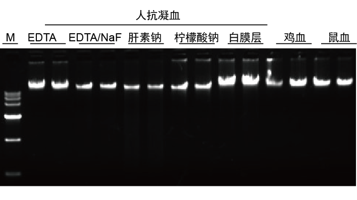 血液基因组DNA提取系统(0.1-20 ml)(DP349)