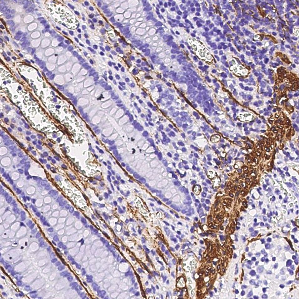 Actin (ACTA2) 兔多抗 (抗原亲和纯化)