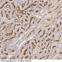 ENPEP / Aminopeptidase A 兔多抗