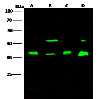PCNA 兔多克隆抗体