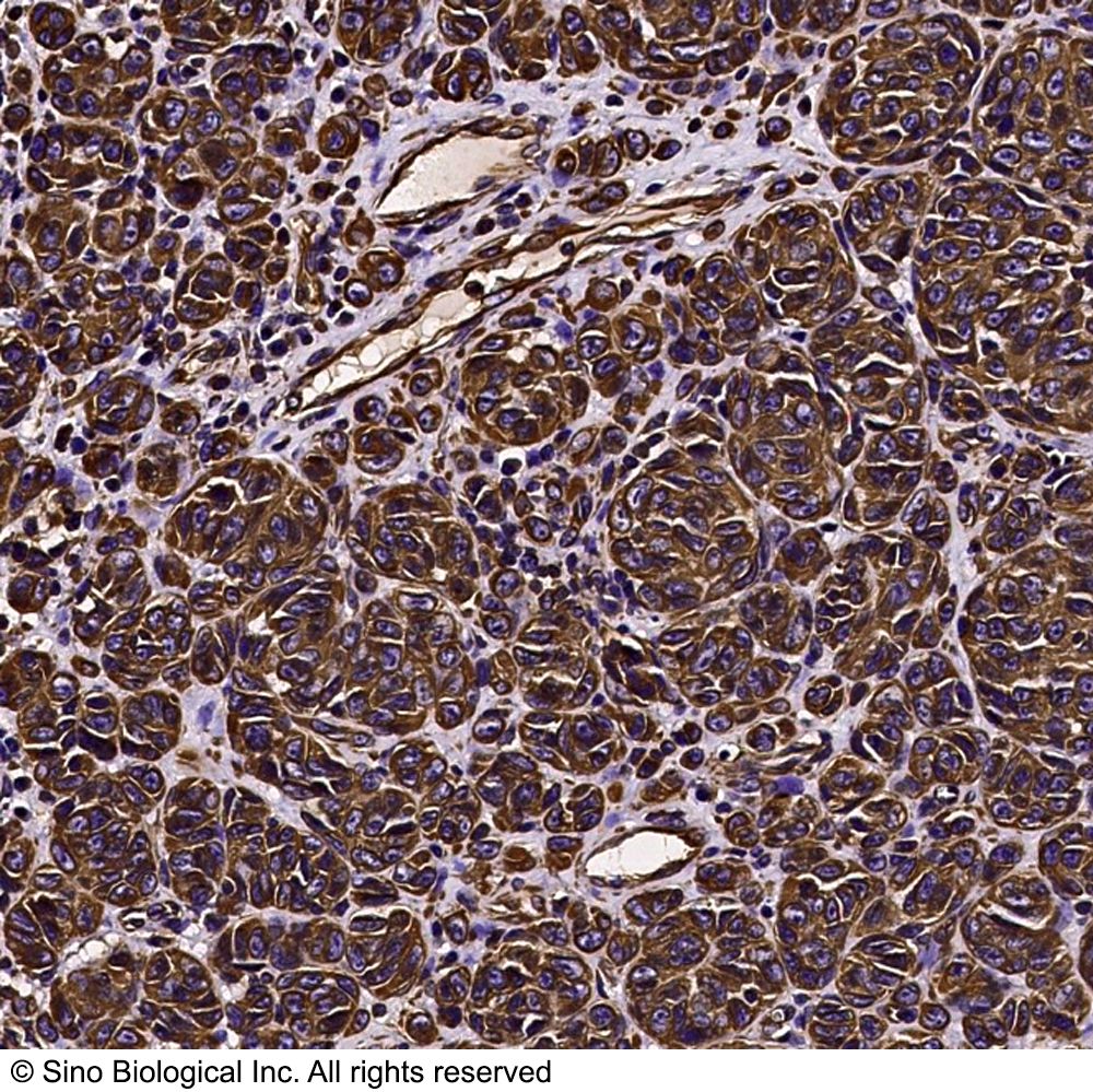 Vimentin  Antibody, Rabbit PAb, Antigen Affinity Purified | Vimentin 兔多抗 (抗原亲和纯化)