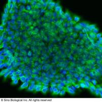 TUBB3 / beta III Tubulin, Rabbit PAb | TUBB3 / beta III Tubulin 兔多抗