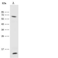 Vimentin/VIM Antibody, Rabbit PAb, Antigen Affinity Purified | Vimentin/VIM 兔多抗 (抗原亲和纯化)