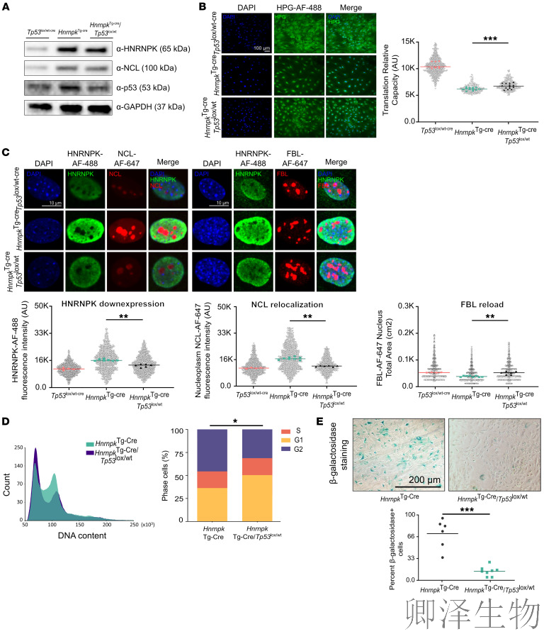 【核糖体疾病】 | 肿瘤抑制因子“黑化”记：过量HNRNPK如何引爆细胞核仁，诱发罕见血液病
