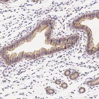 IL1R1/IL-1R1/IL-1 RI 兔多抗