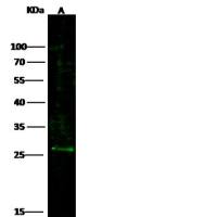BAMBI / NMA Antibody 兔多抗 (抗原亲和纯化)