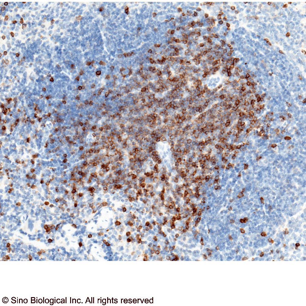 CD5 / LEU1 Antibody, Rabbit PAb, Antigen Affinity Purified | CD5 / LEU1 兔多抗 (抗原亲和纯化)