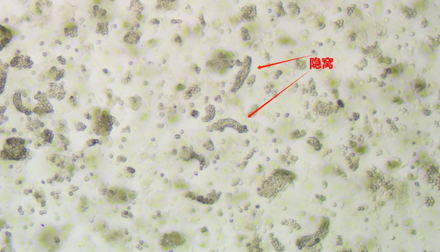 小鼠结肠炎类器官诱导攻略