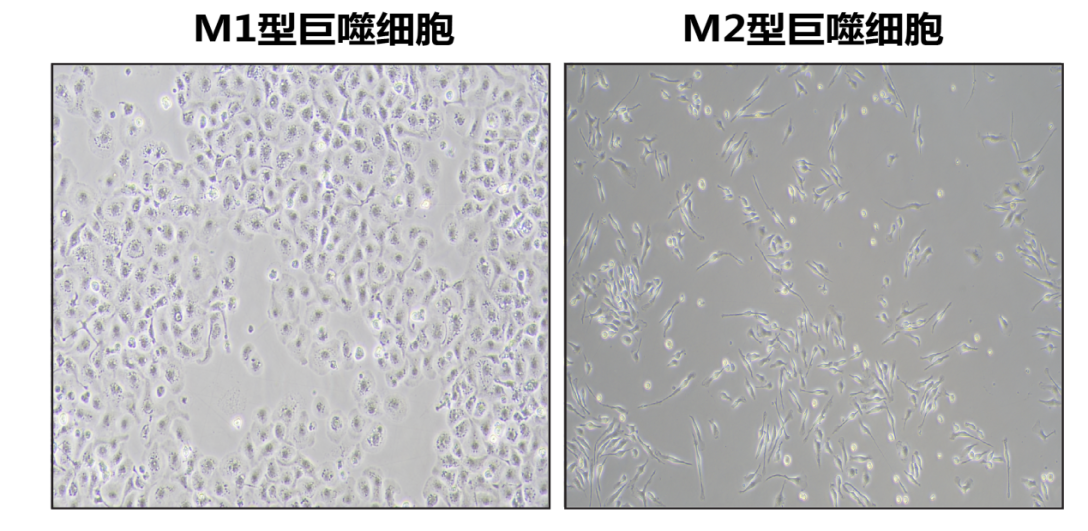  C57小鼠骨髓细胞极化M1和M2形态对比