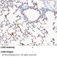 LCN2 / NGAL 兔多抗 (抗原亲和纯化)