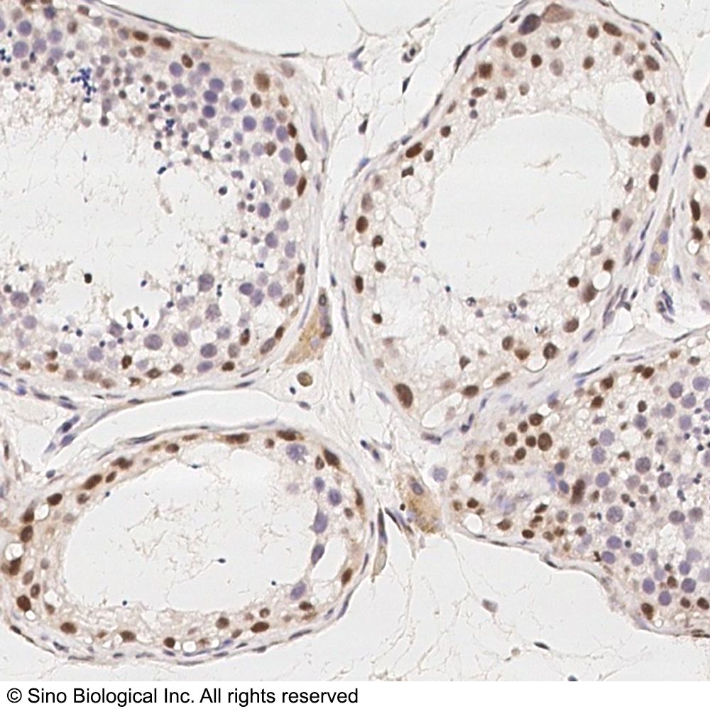 PIWIL4 Antibody, Rabbit PAb, Antigen Affinity Purified | PIWIL4 兔多抗 (抗原亲和纯化)