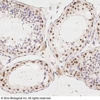 PIWIL4 Antibody, Rabbit PAb, Antigen Affinity Purified | PIWIL4 兔多抗 (抗原亲和纯化)